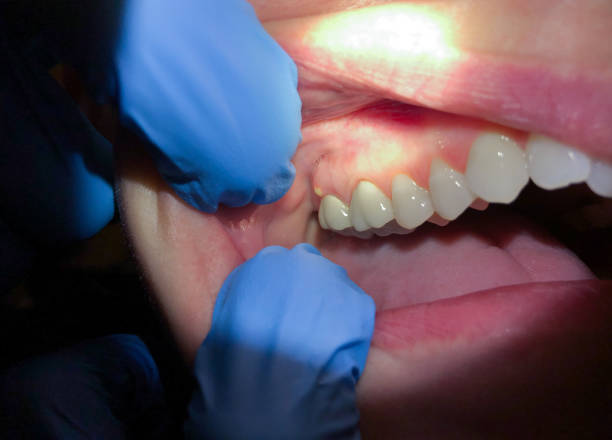 Best Tooth Pain Emergency Relief  in Concord, MI