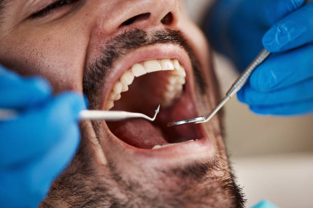 Best Emergency Gum Pain Relief  in Concord, MI