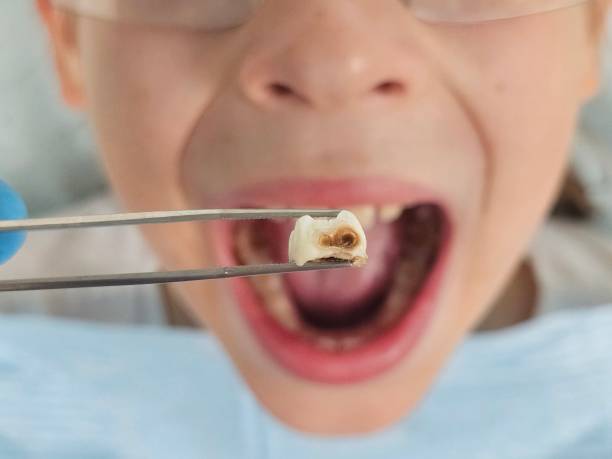 Best Affordable Emergency Dental Care  in Concord, MI