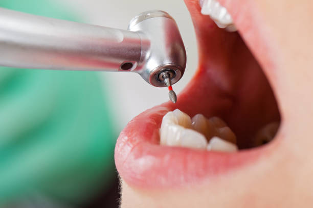 Best Broken Tooth Emergency  in Concord, MI